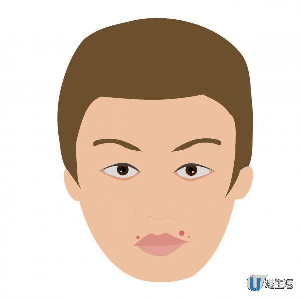 左边双颊:若只有左边脸颊有暗疮则表示肝火或肝血不足.