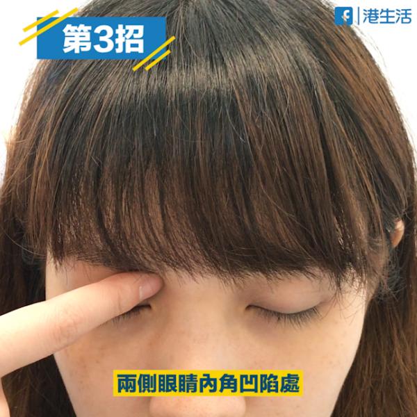 晴明穴两侧眼睛内角凹陷处,约於眉头下方.