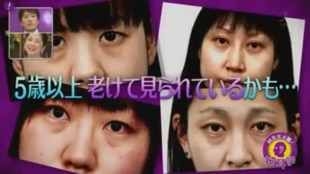 黑眼圈令人望落老5歲 日本醫生教你奇招減退青色 茶色 黑色眼圈 港生活 尋找香港好去處